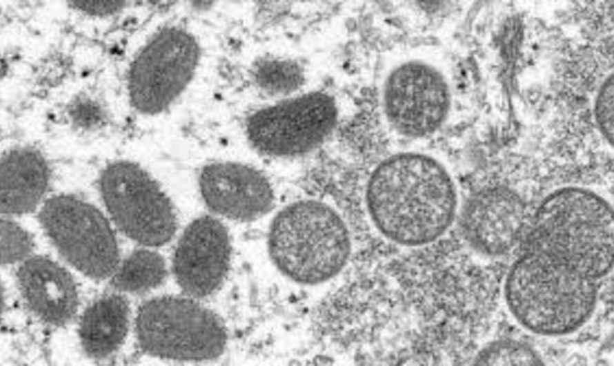 Santé: les États-Unis déclarent l’épidémie de variole du singe urgence de santé publique